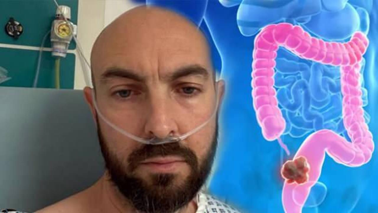 43 yaşında kolon kanseri teşhisi konuldu: “Görmezden geldim!”
